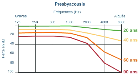 presbyacousie